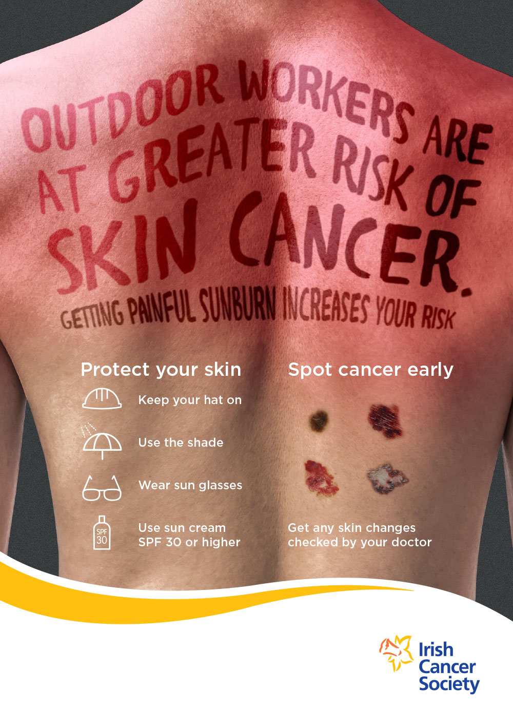 SunSmart- Outdoor workers poster