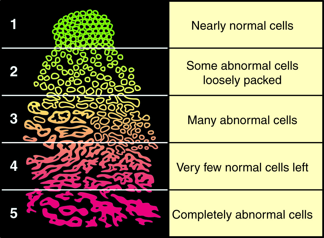 Gleason Colour Scale