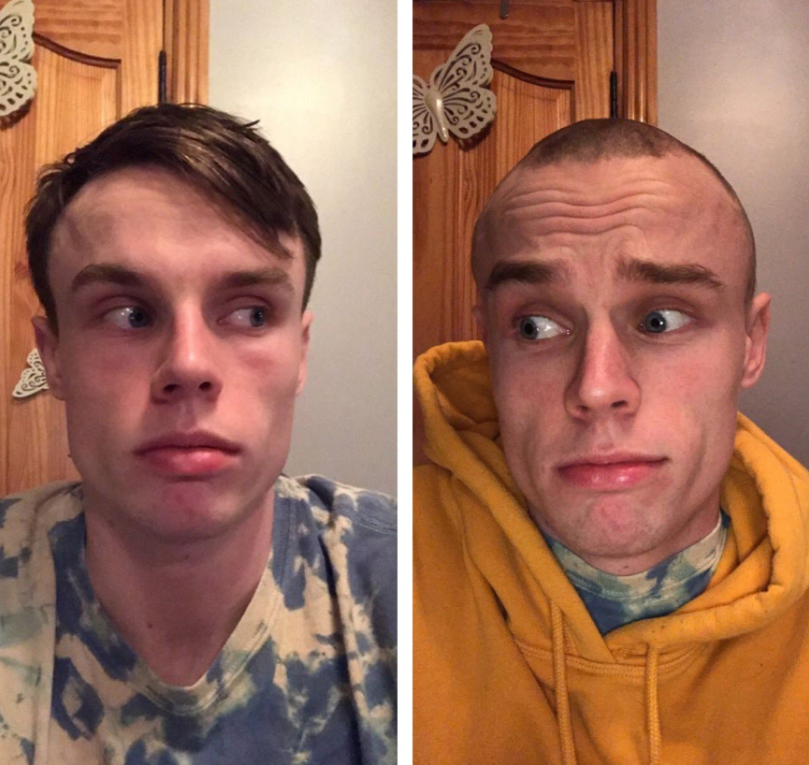 Ballincollig Basketball head shave fundraiser