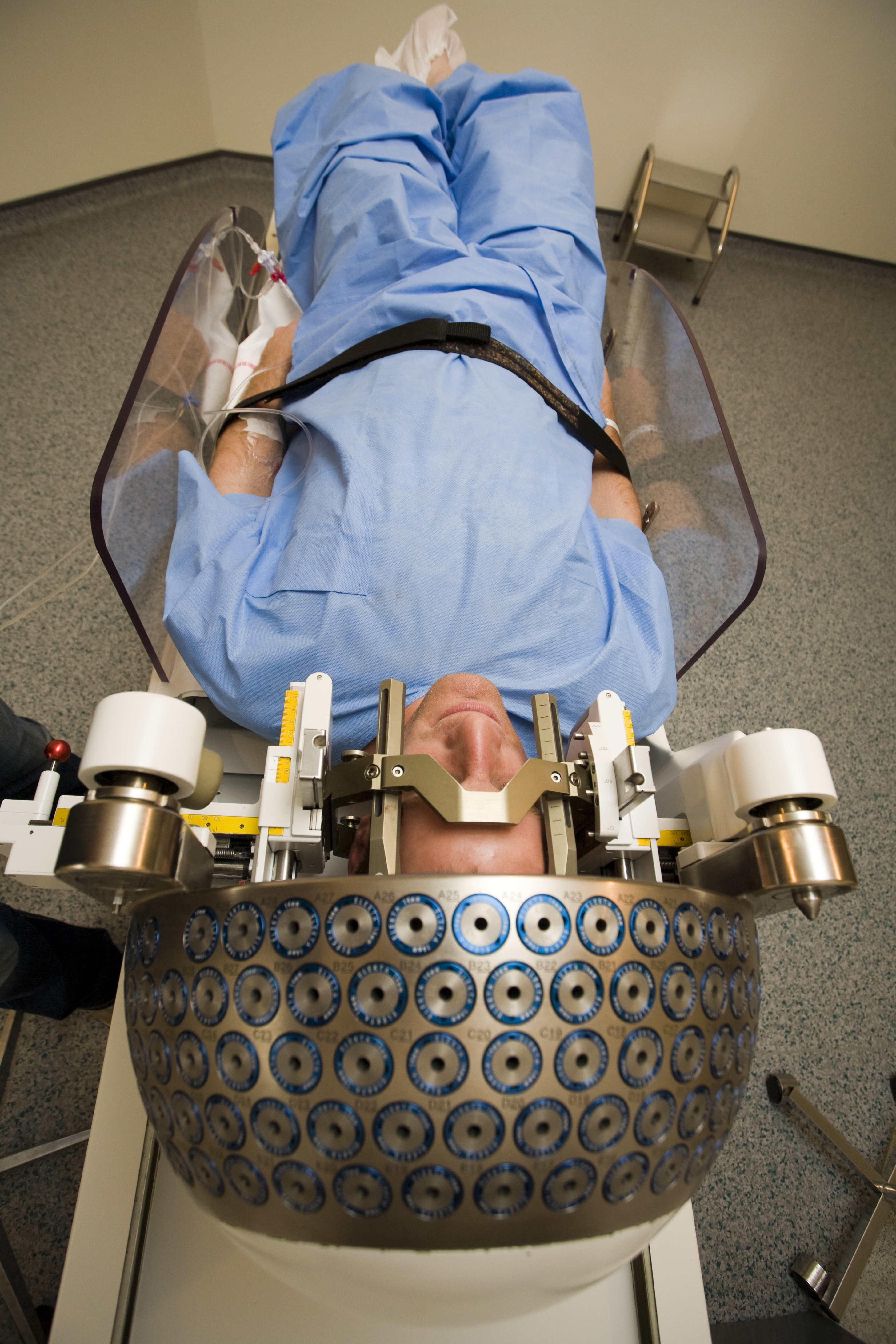 A man lying on a bed with a big metal apparatus on his head, a bit like a very big helmet