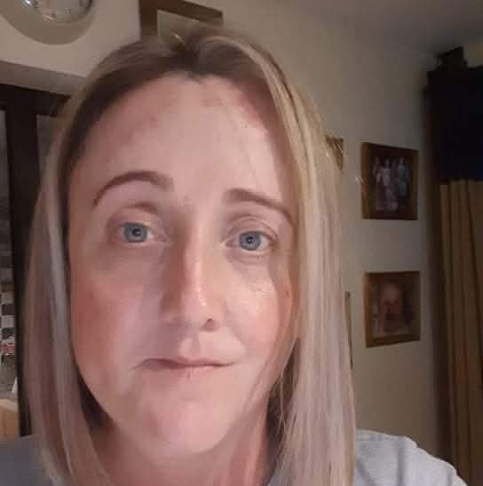 Press Release: Skin cancer survivor who lost her father to skin cancer shares her story to encourage people to get skin changes checked and practise sun safety