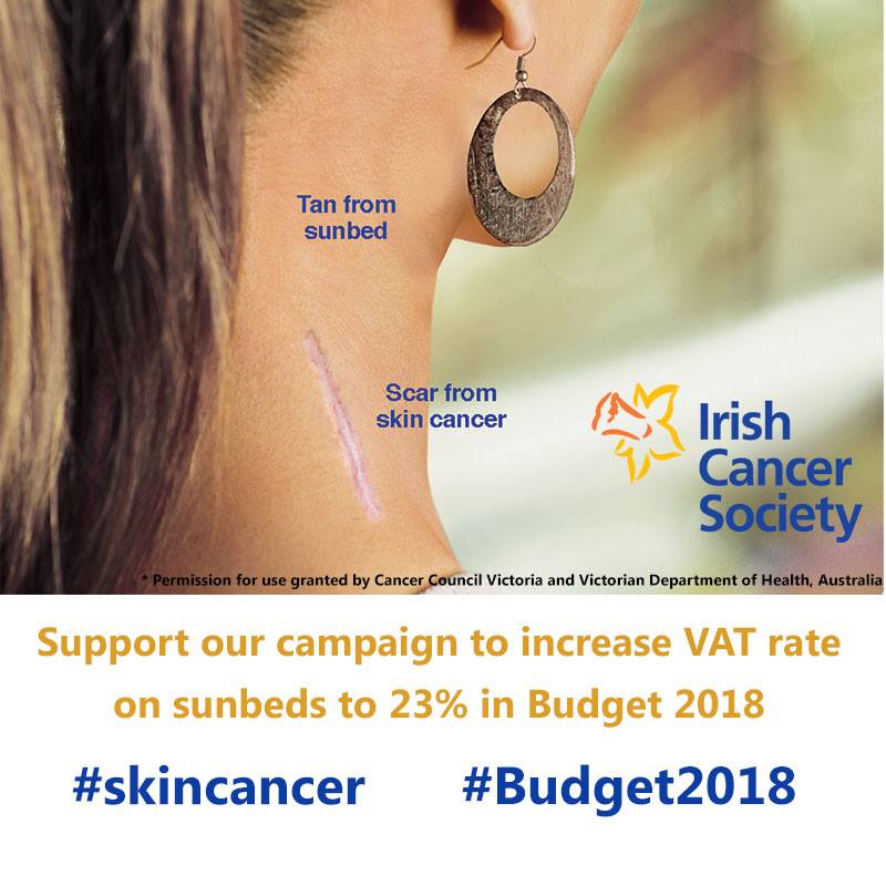 Irish Cancer Society welcomes 50 cent increase to cigarettes and VAT increase on sunbeds