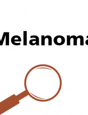 Be skin smart - Signs of melanoma