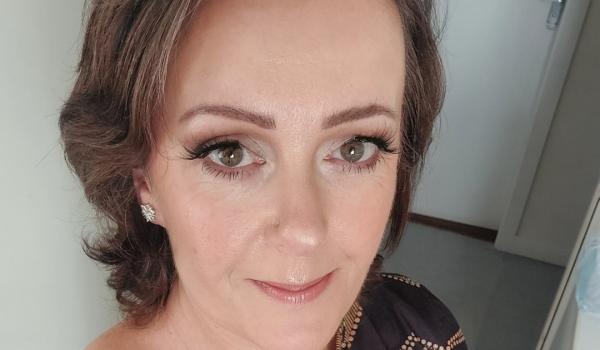Fiona White's Skin Cancer Story