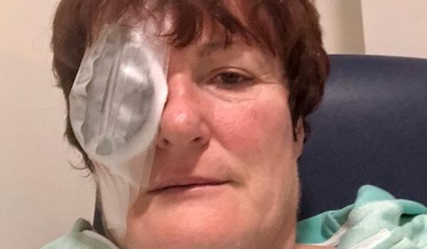 Elaine O’Callaghan's Eye Cancer Story