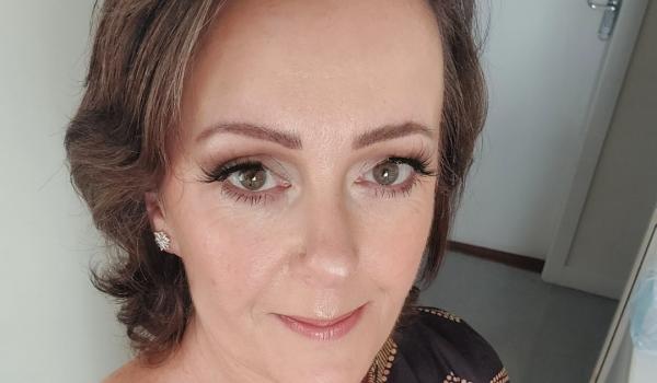 Press Release: Skin cancer survivor shares her story to encourage others to get skin changes checked and to practise sun safety