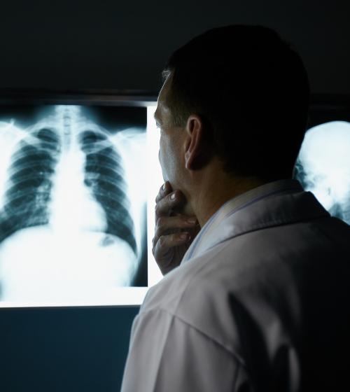 Doctor looking at scan