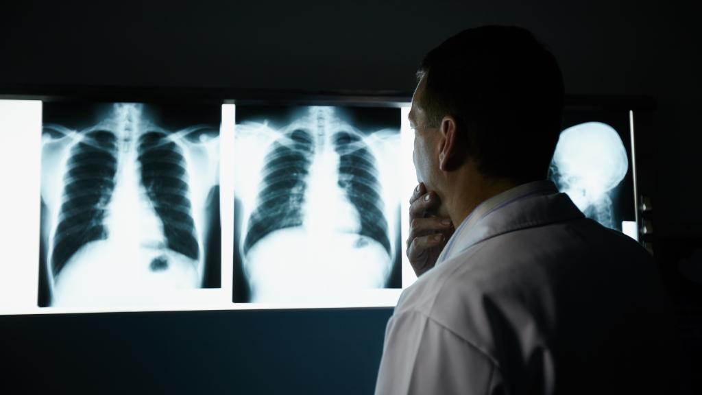 Doctor looking at scan