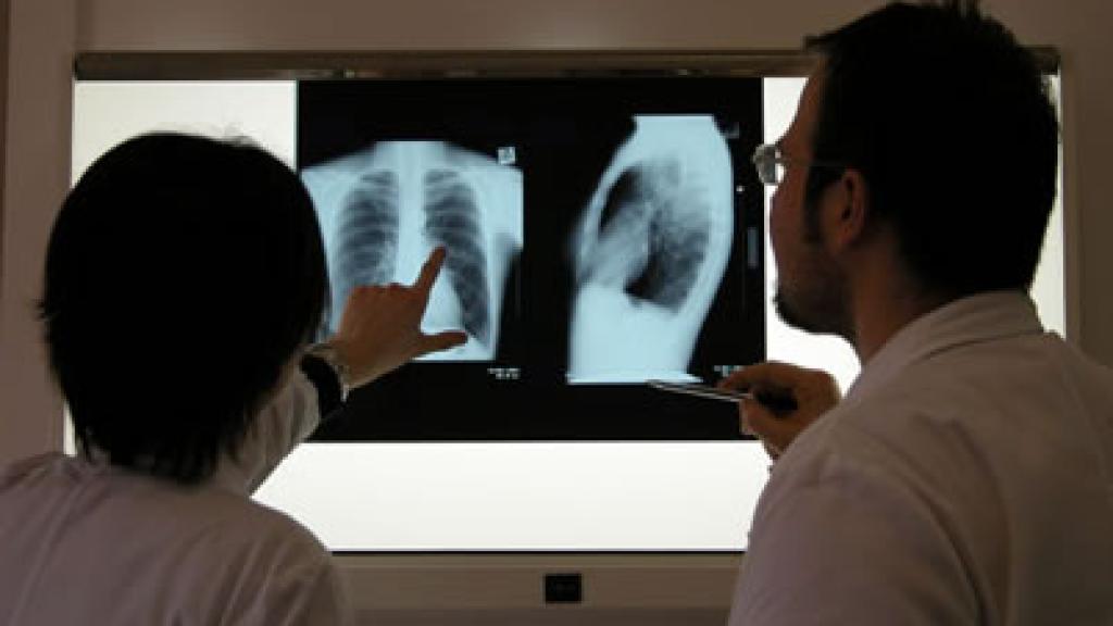 Doctors looking at a lung x-ray