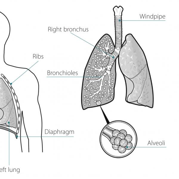 Mesothelioma | Irish Cancer Society