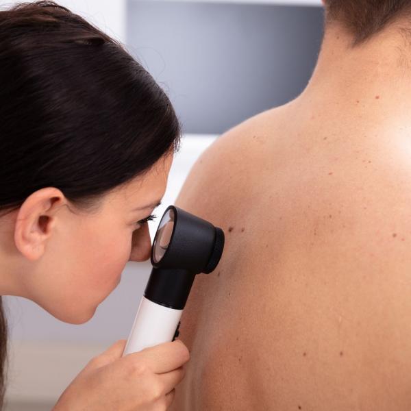 Dermatologist examining skin