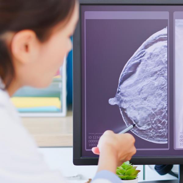 female doctor looking at mammogram