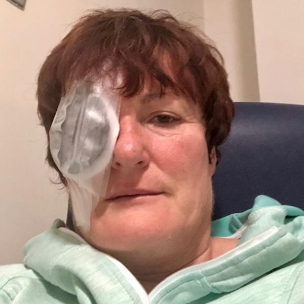 Elaine with Eye Patch