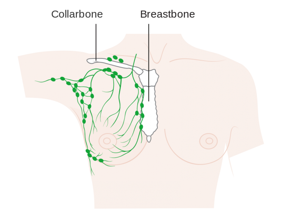 Cording After Breast Surgery: 7 Things To Know About Axillary Web