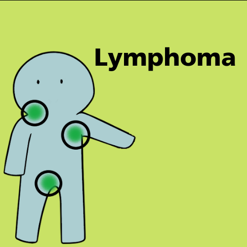 Lymphoma infographic thumbnail