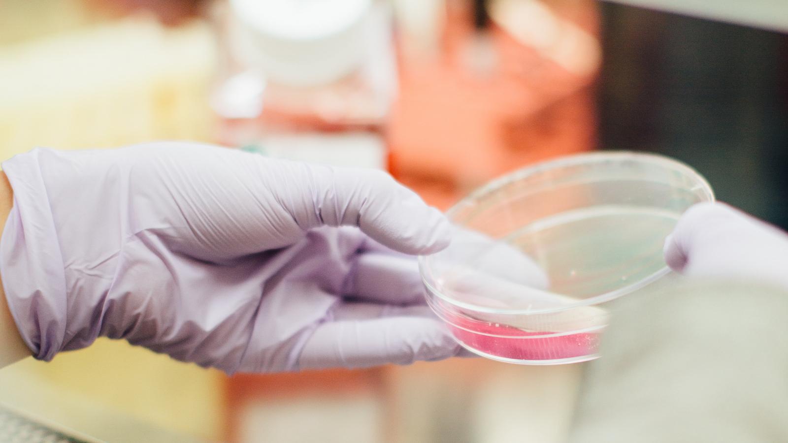 a gloved hang holding a medical research dish (petri dish) with pink liquid in it.