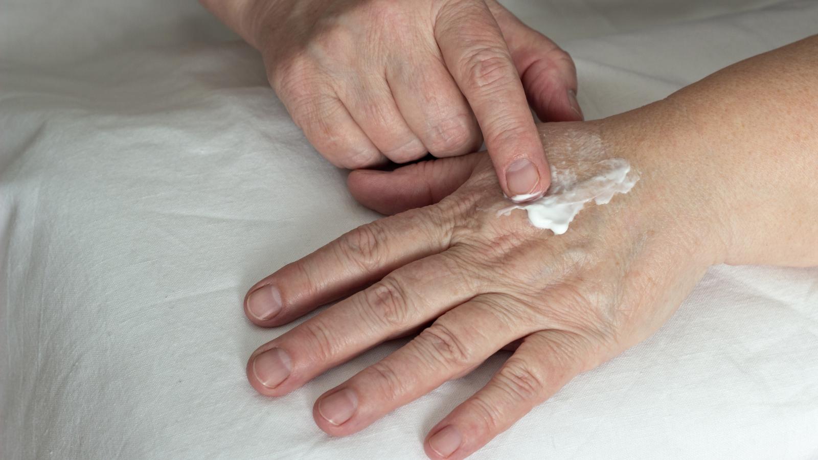 Old man putting moisturiser on his hands