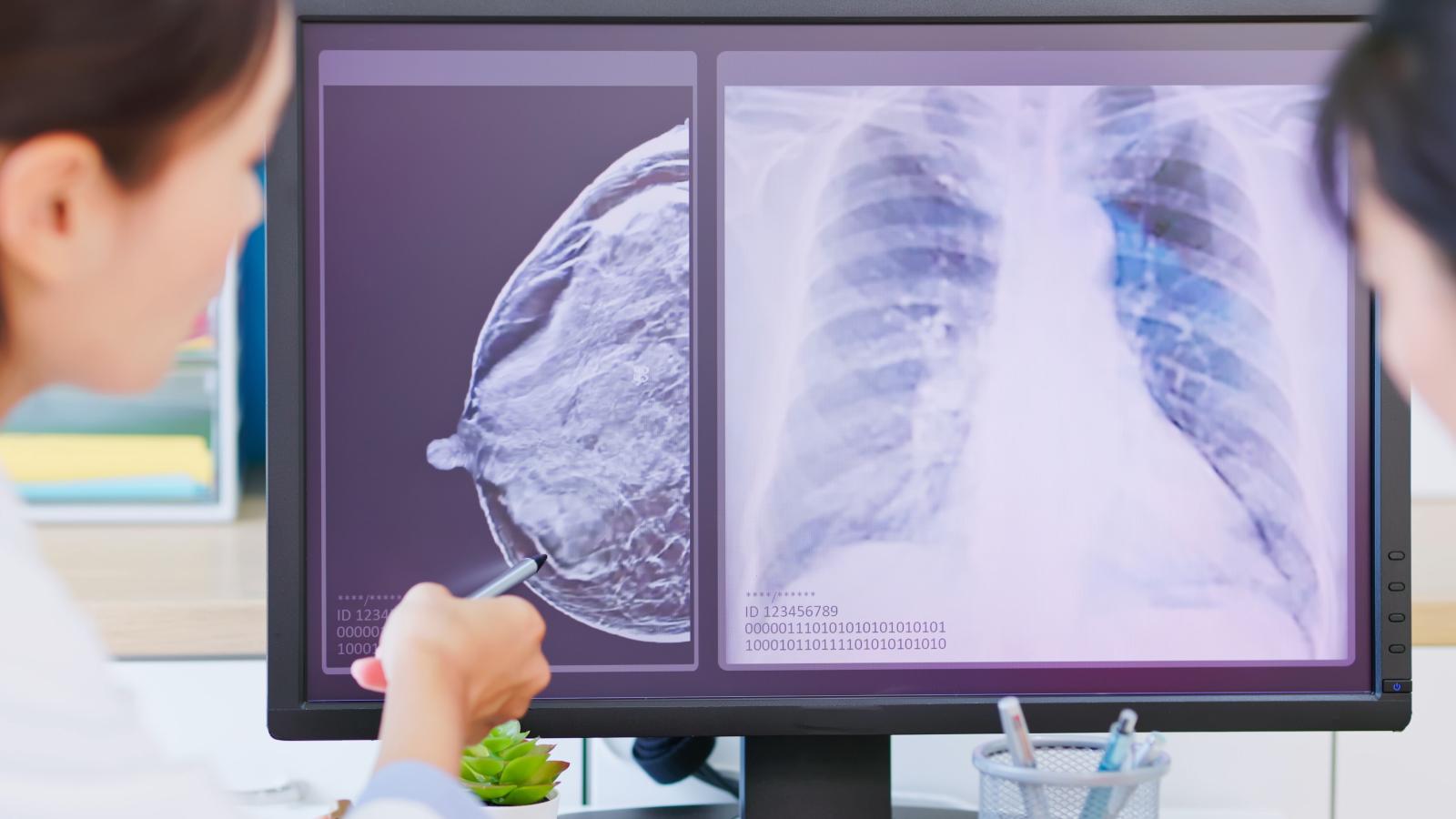 female doctor looking at mammogram