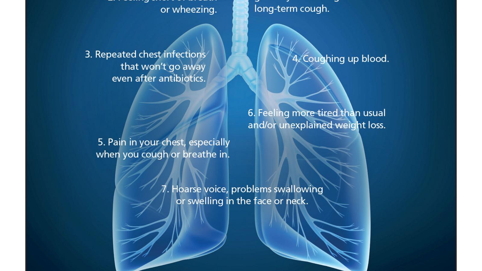 mesothelioma cancer charity